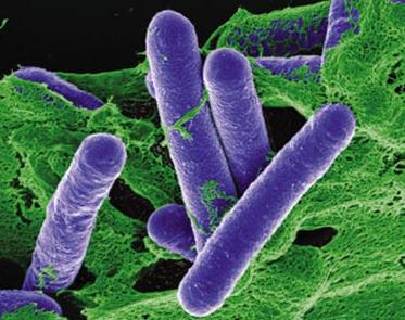 Clostridium botulinum bacteria -s
